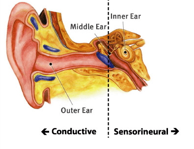 types-of-hearing-loss types of hearing aids