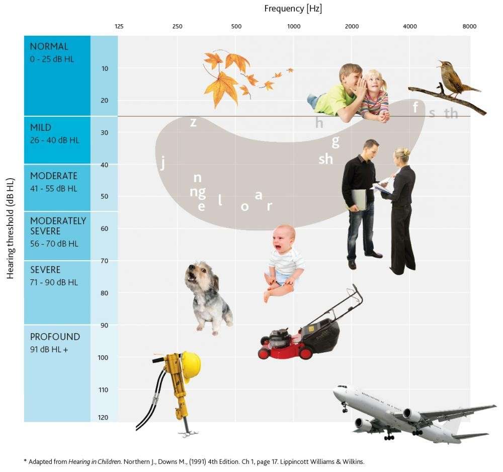 types of hearing aids